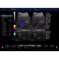 Trolley vascular doppler & color doppler ultrasound price DW-C80